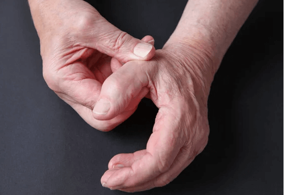 thumb arthritis test