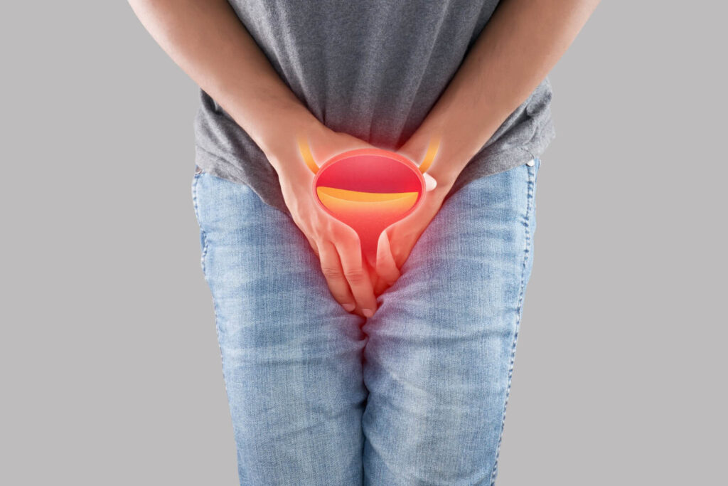 acute cystitis | urinate