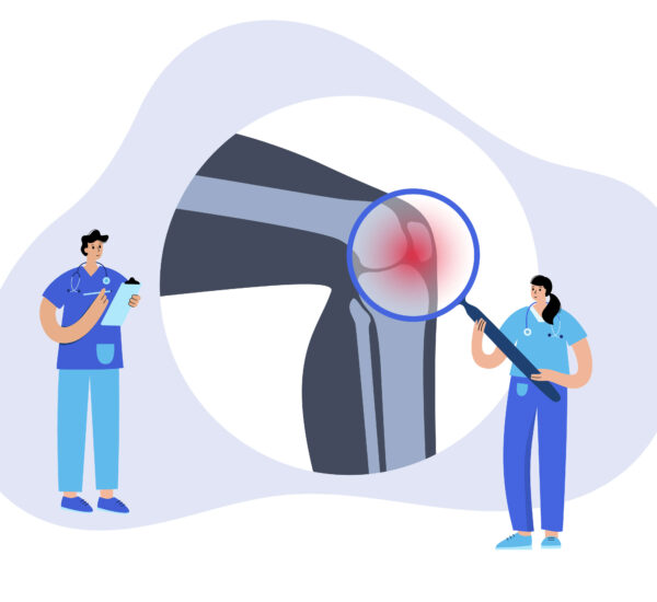 rheumatoid arthritis