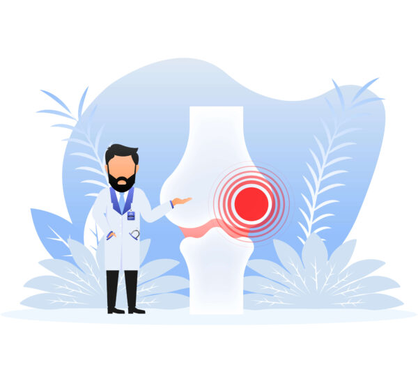 rheumatoid arthritis causes