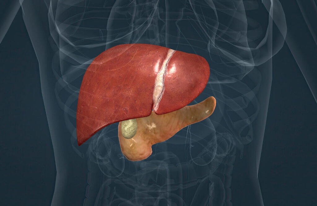 inflammation of the liver