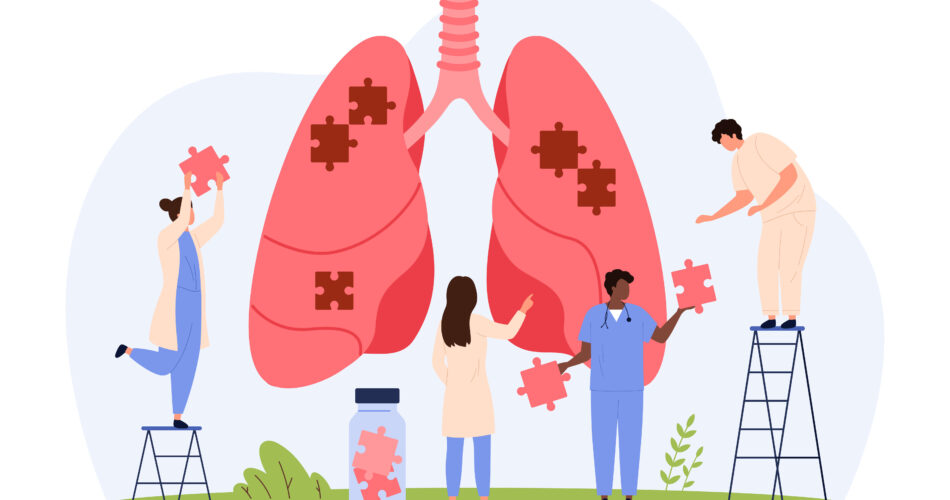 bronchial asthma in acute exacerbations