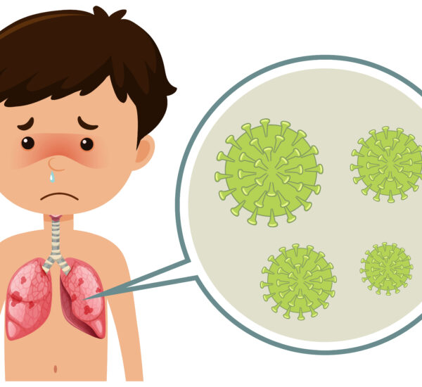 whooping cough phases