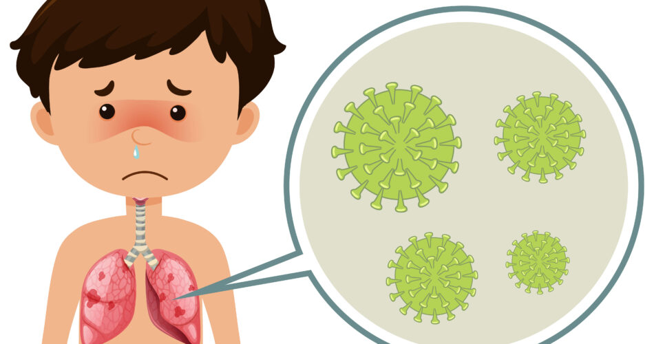 whooping cough phases