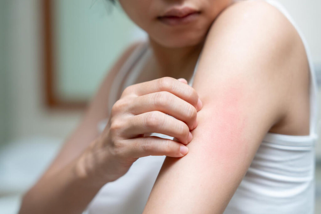 person showing signs of skin irritation