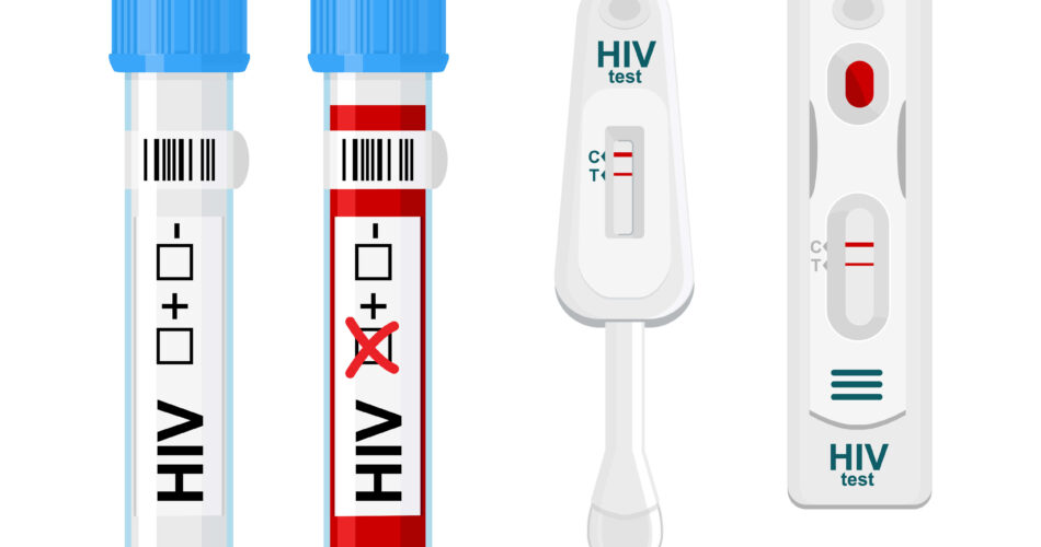 hiv test kit