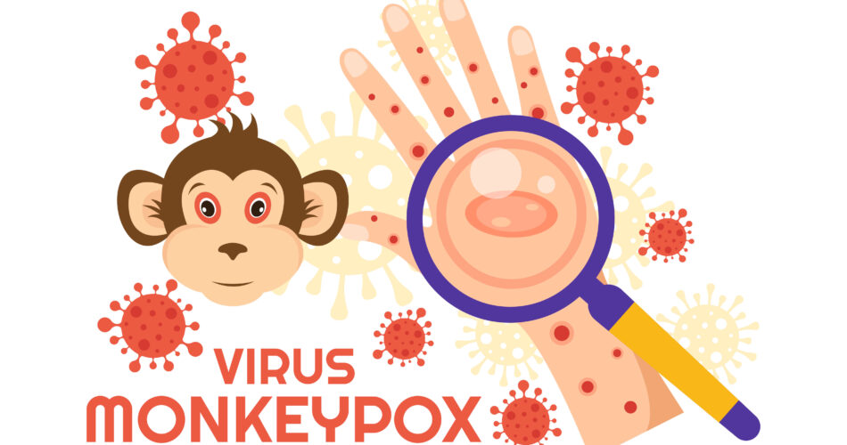 monkeypox