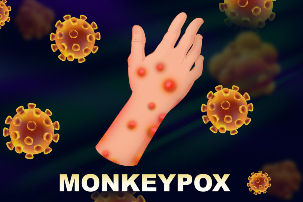 gabay tungkol sa monkeypox virus - paghawa ng mpox