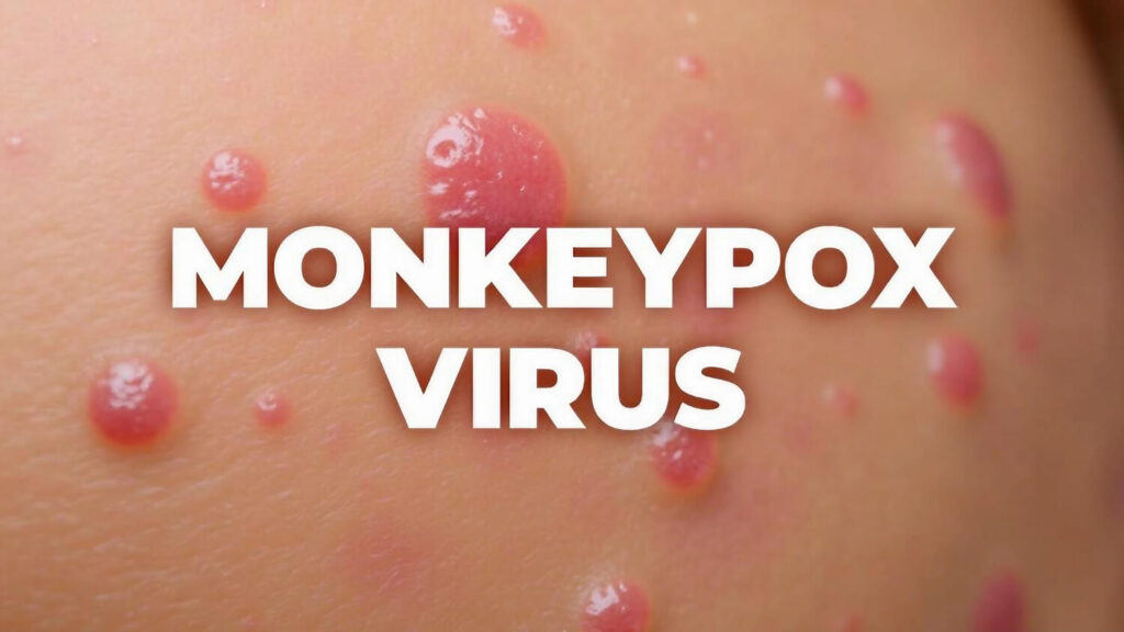 mpox virus - mpox spread