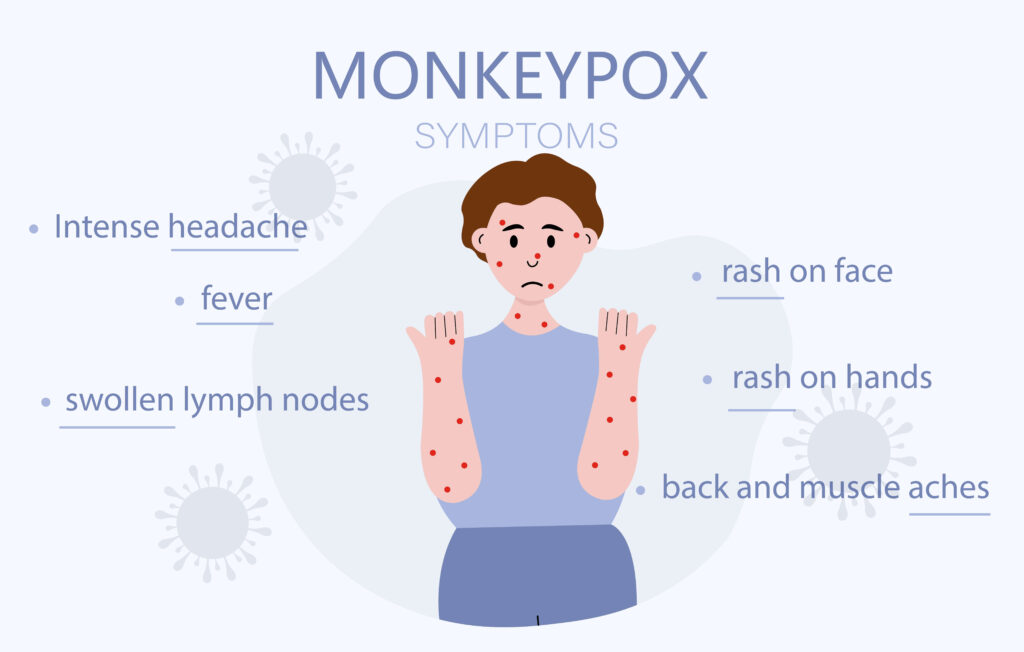 symptoms of monkeypox guide