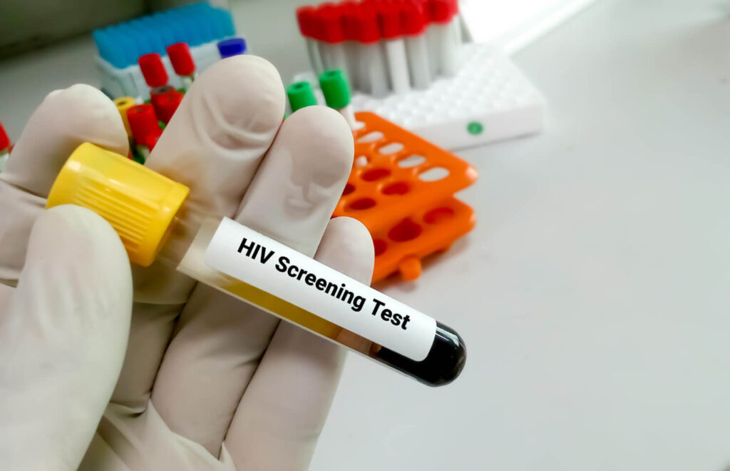 HIV screening test for early detection of HIV infection