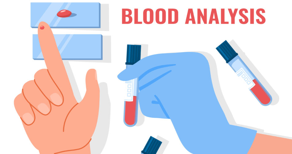 hiv sample collection