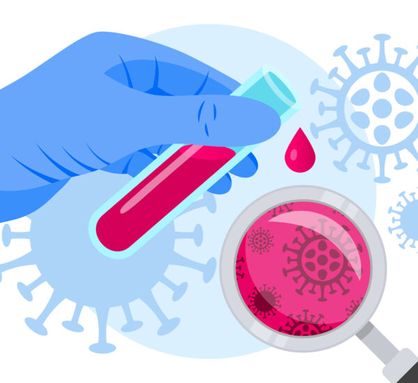 reading hiv test results