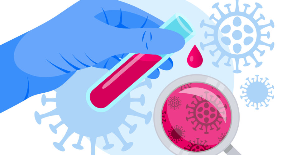 reading hiv test results