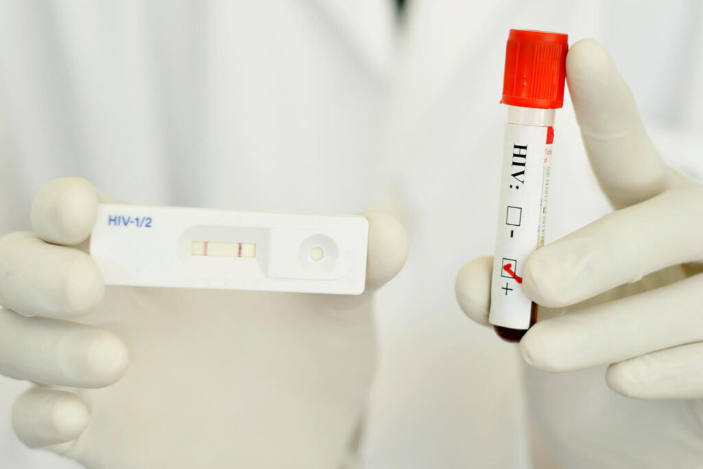 reading hiv test results - rapid test and antigen test