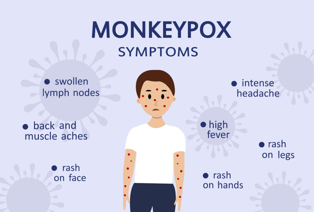 mga sintomas ng Mpox - malubhang sintomas ng mpox