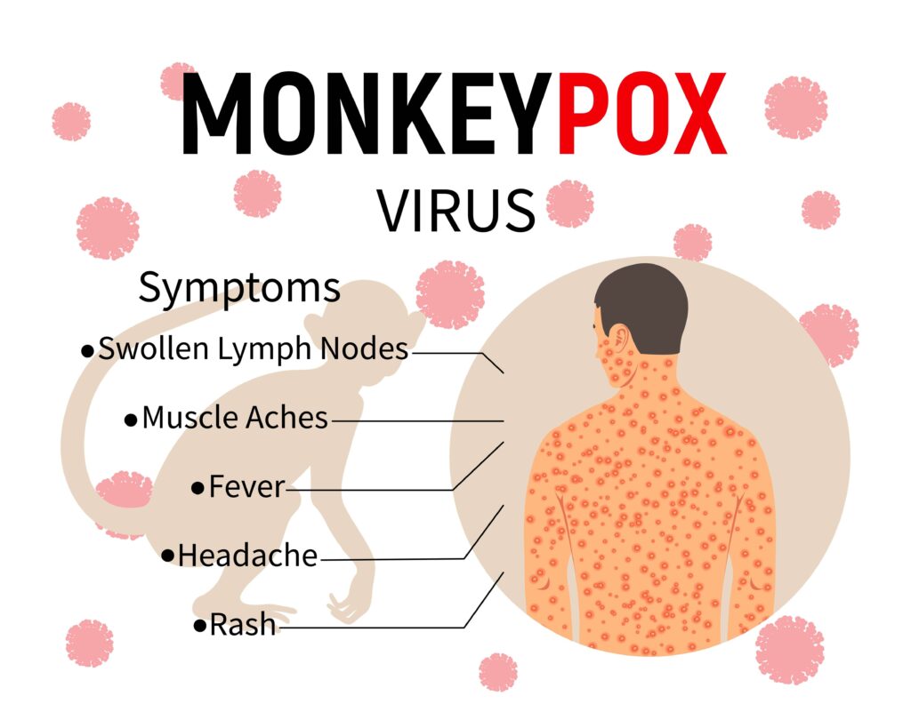 pangkaraniwang sintomas ng mpox