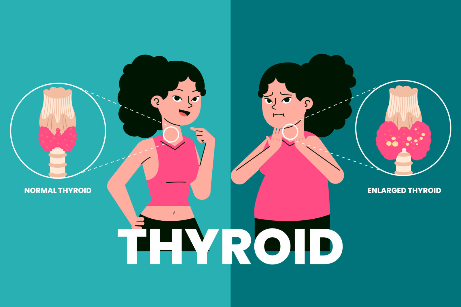 Detect Symptoms of Thyroid Problems and Take Action Now