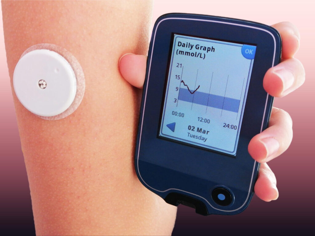 CGM device