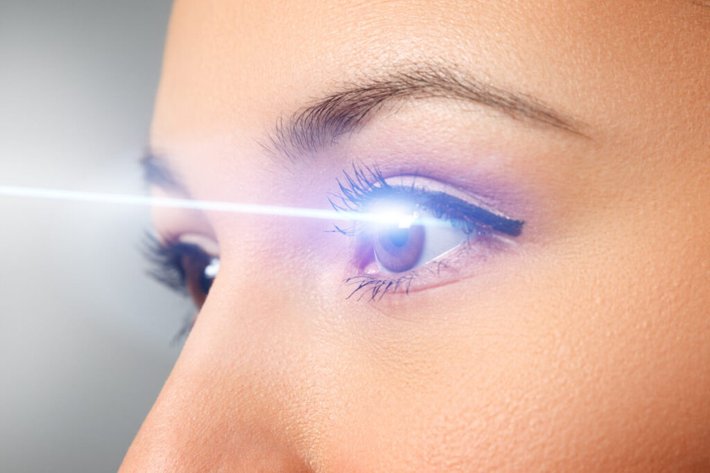 LASIK procedure - excimer laser