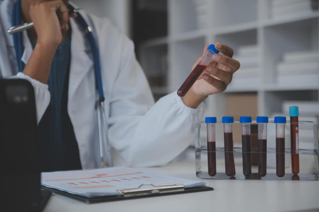 glucose testing - blood vials laboratory test