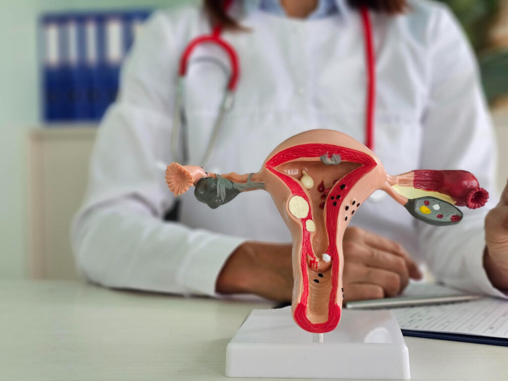 consult an OBGYN for endometriosis pain