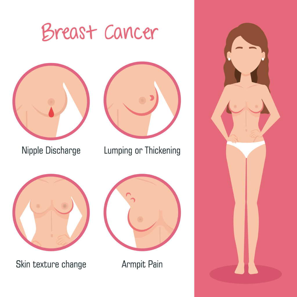 lump in breast warning signs of breast cancer