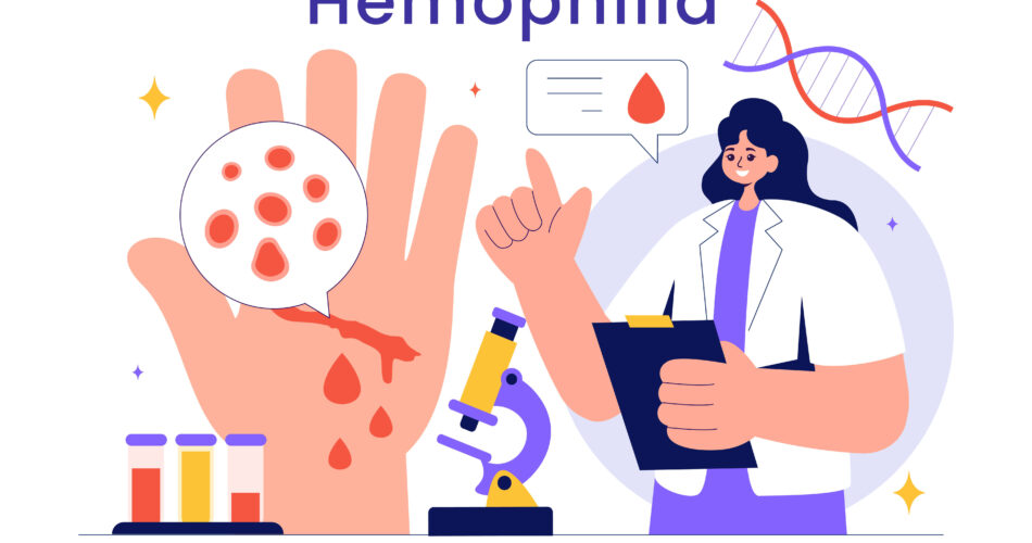 hemophilia a and b