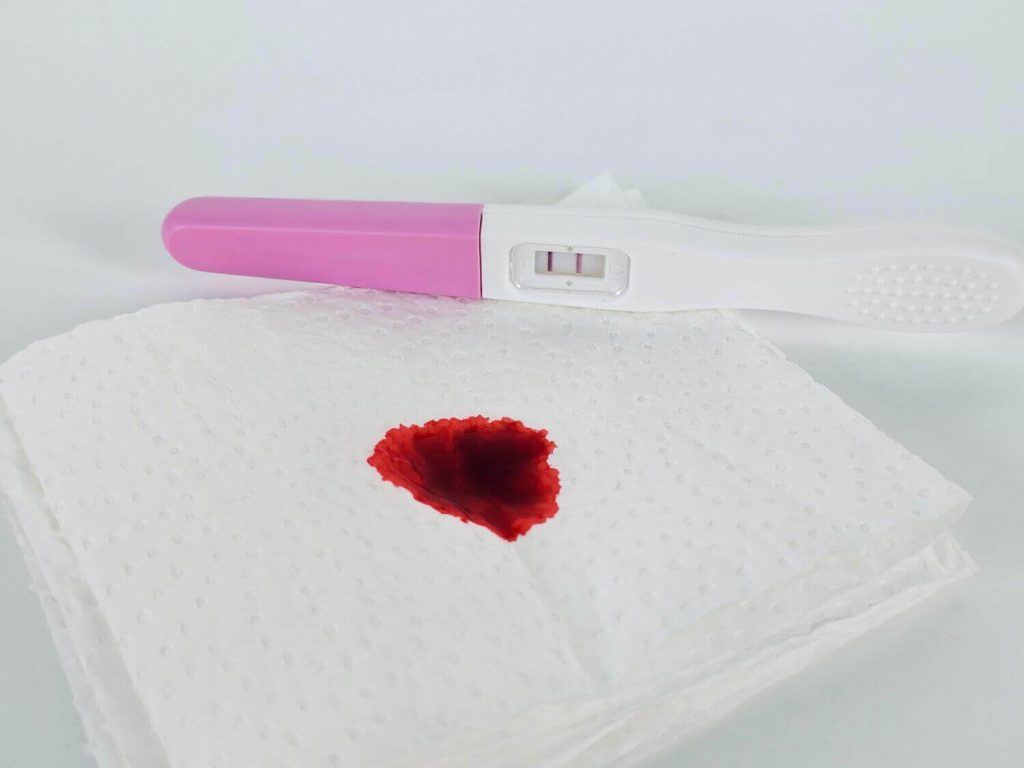 bleeding during pregnancy vs menstrual bleeding