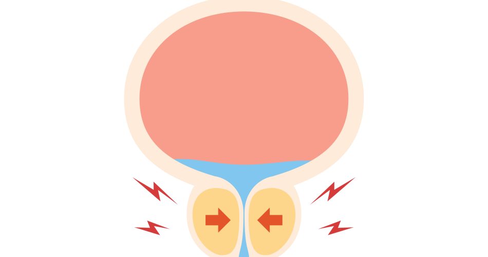 enlarged prostate treatment