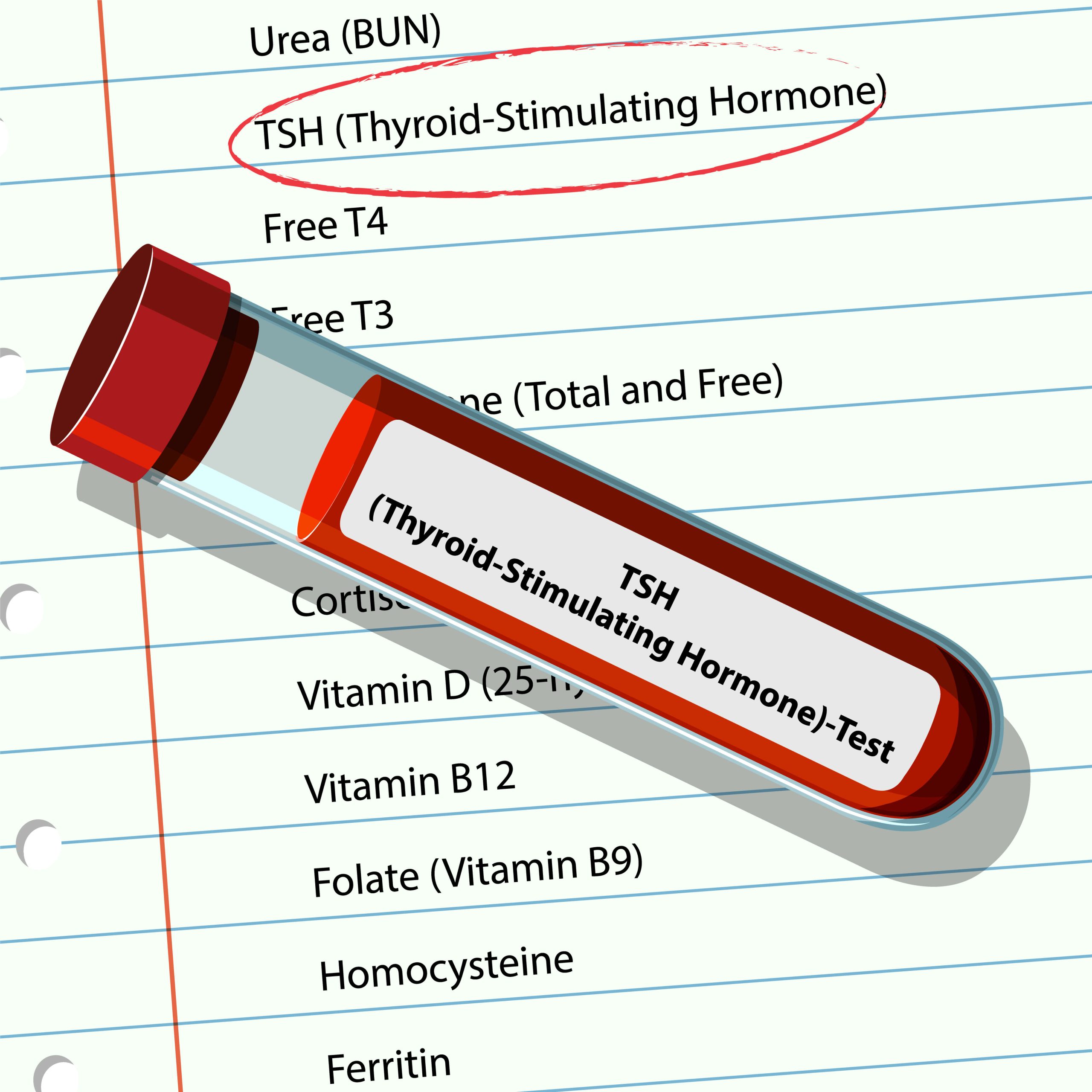 thyroid stimulating hormone test - hormone panel philippines