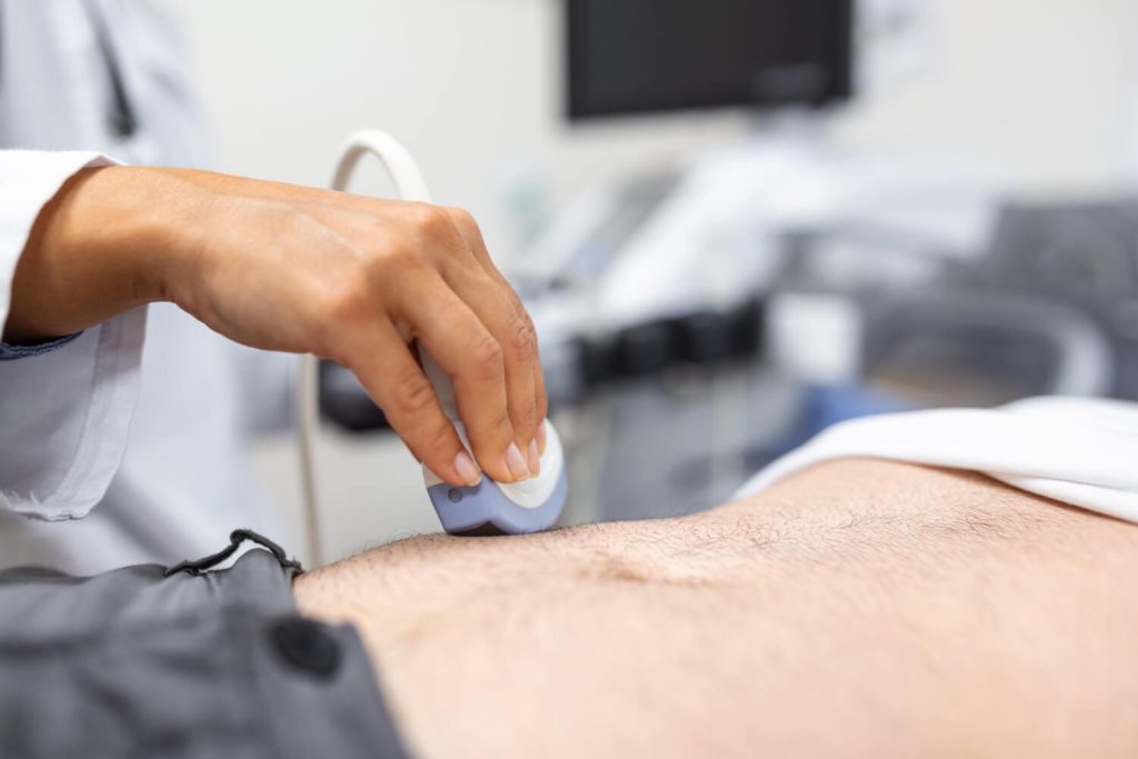 abdomen ultrasound