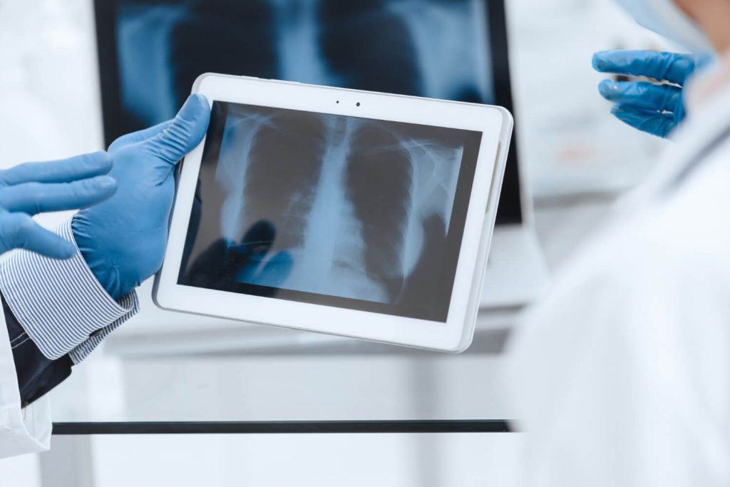 chest x-ray