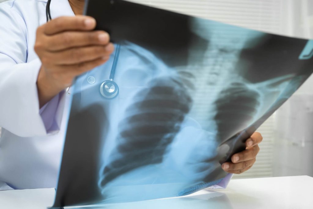 chest x-ray reading test