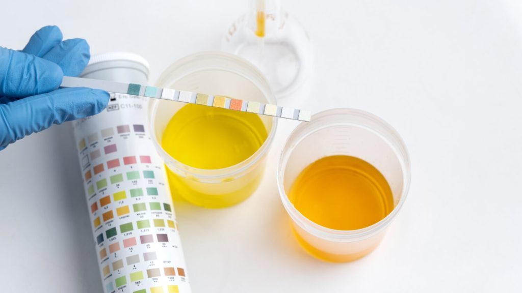 urine test samples